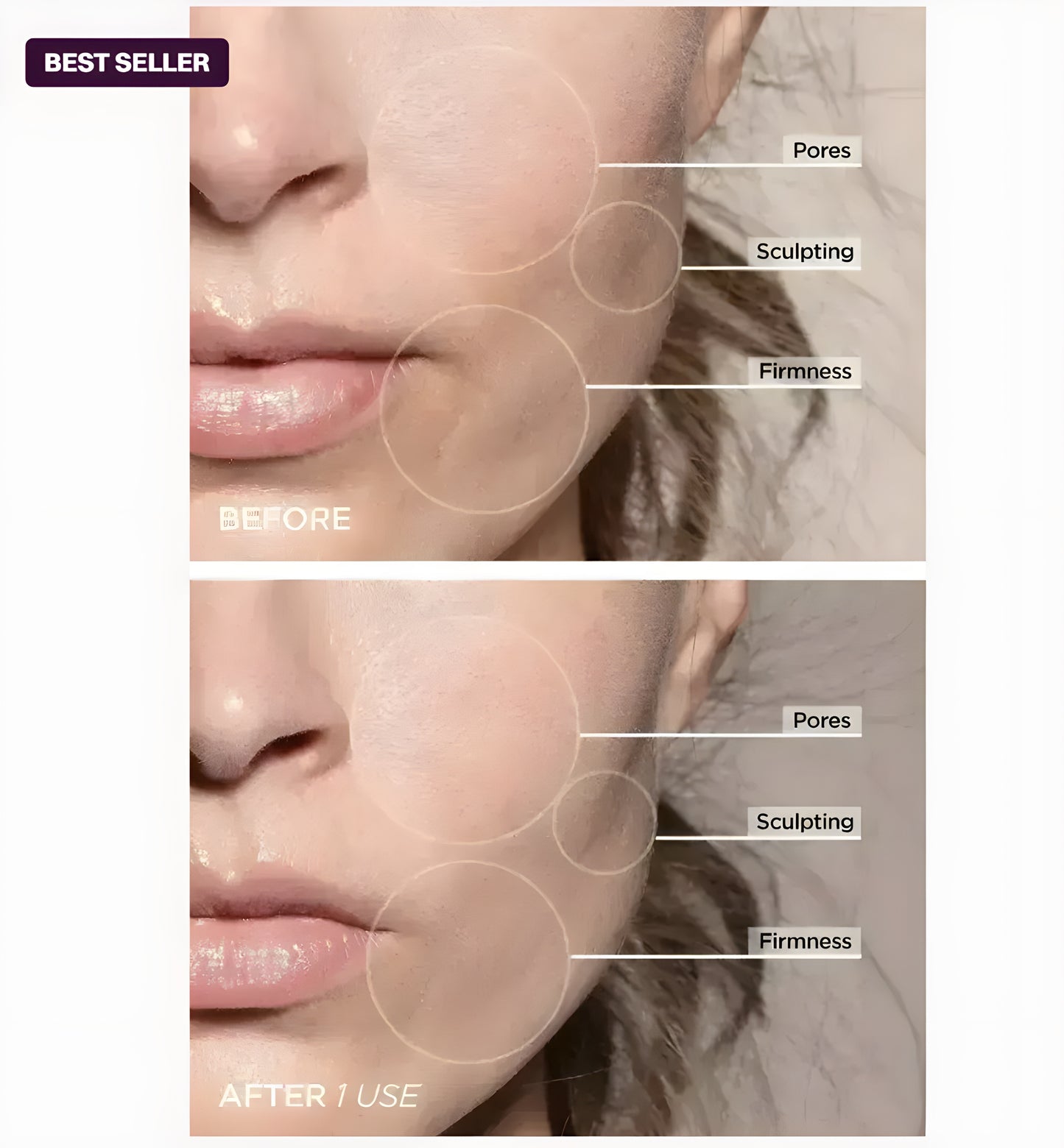 Belmoire 3 in 1 Facial Sculptor - Belmoire